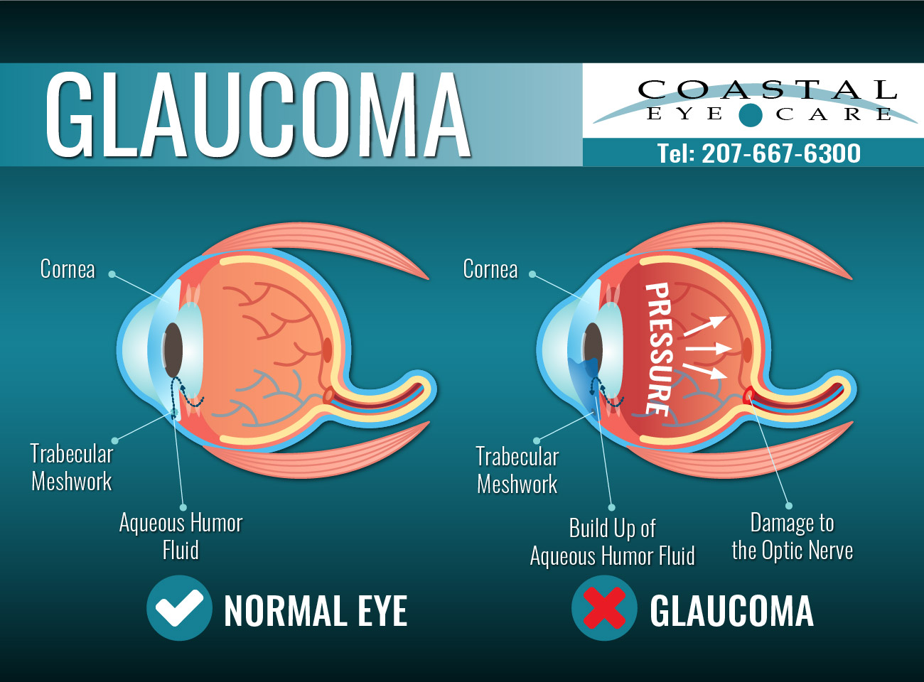 Diagnosis & Treatment for Bangor, ME Coastal Eye Care